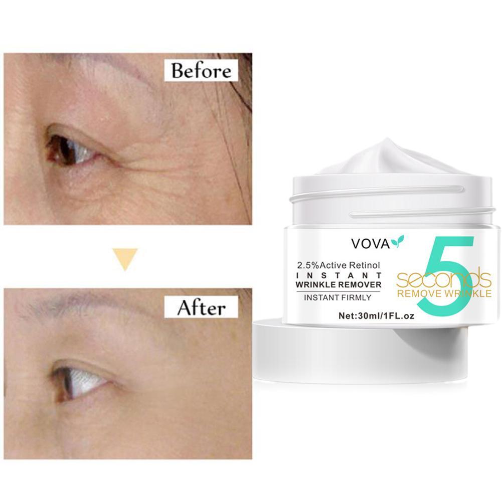 2.5% Active Retinol Eye Cream  - Milk Thistle Silymarin avaliação e preço